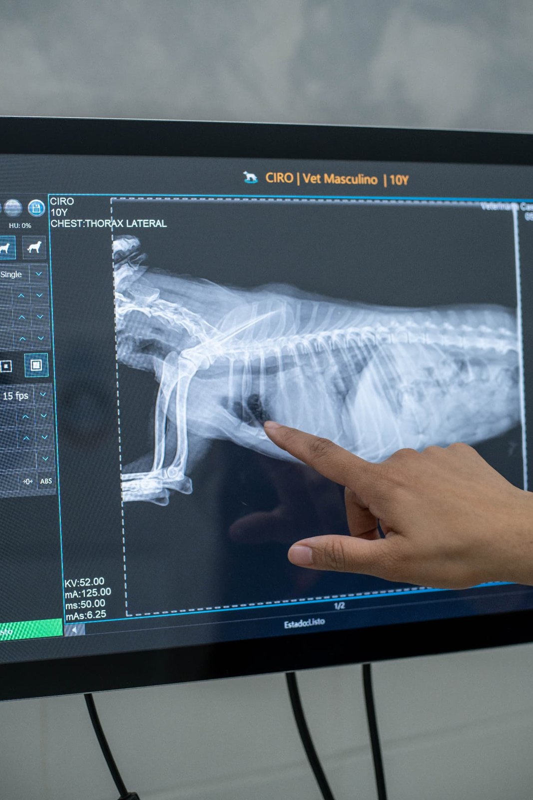 Radiografía digital de tórax en el monitor del centro